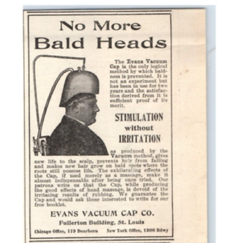 1903 Print Ad Evans Vacuum Cap Company No More Bald Heads Quack Medicine Ohio!
